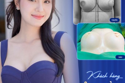 Lột xác vóc dáng – Hành trình nâng ngực tại Sao Hàn