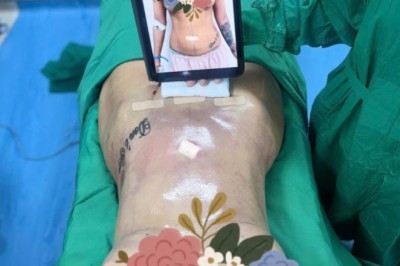 BÊN TRONG PHÒNG MỔ: MỘT CA HÚT MỠ DIỄN RA NHƯ THẾ NÀO?