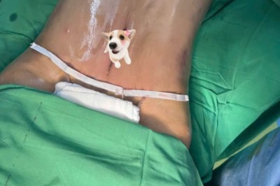 HÚT MỠ BỤNG, TẠO DÁNG BODY: BẠN ĐÃ TÌM HIỂU ĐỦ TRƯỚC KHI QUYẾT ĐỊNH?