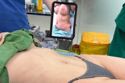 TÌM HIỂU GIÁ HÚT MỠ: ĐỪNG BỎ QUA CÁC QUYỀN LỢI ĐI KÈM!