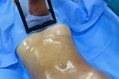 Chuyện chưa kể về dịch vụ hút mỡ: Những điều cần biết trước khi quyết định