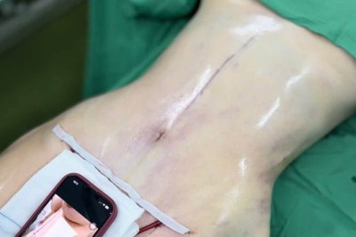 Kinh nghiệm thẩm mỹ: 10 điều cần biết trước khi quyết định làm đẹp