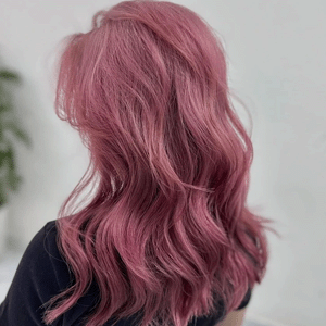 Cấy Mỡ Mặt