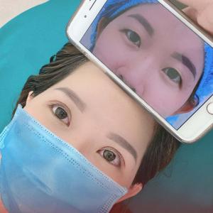 Cắt mắt 2 mí cấu trúc