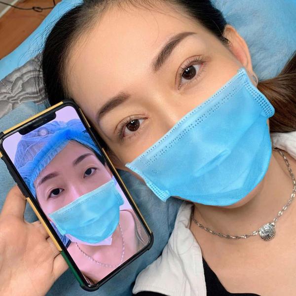 Thẩm mỹ mắt to - 3/3
