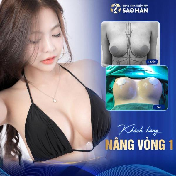 Thu gọn đầu vú