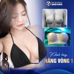 Thu gọn đầu vú