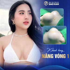 Cắt bỏ mô tuyến vú