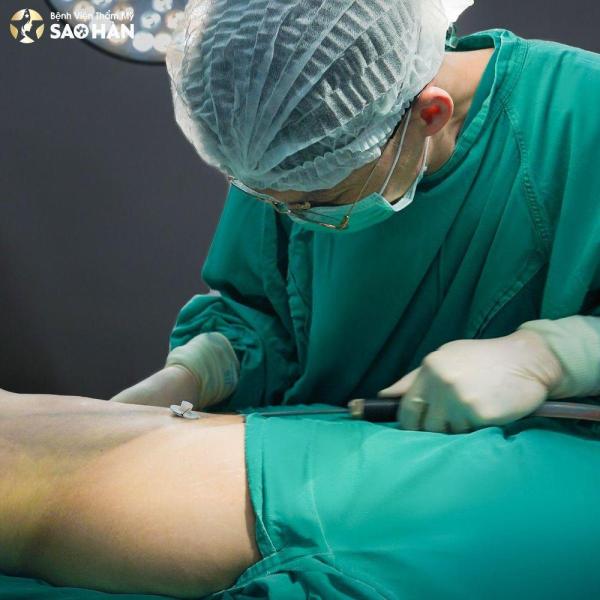Xử lý tai biến sau hút mỡ - 3/3
